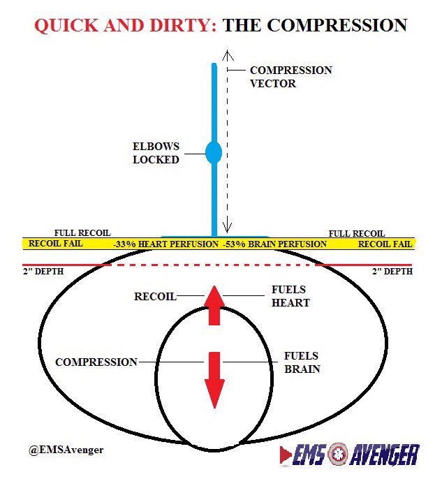 EMSAvenger's tweet photo. There's one right way to perform chest compressions- Kneeling at the side of the patient with arms locked. NOT STANDING. NOT WITH ONE HAND.
-Allow full recoil
-Stay between 100-120 compressions/minute
#OHCS #Resuscitation #CPR https://t.co/rZKFvQxnZV