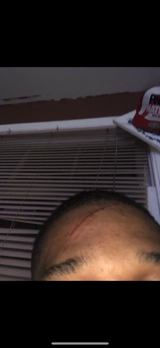 D_Will98's tweet photo. So since we Tellin stories... this Bitch was abusive, A Cheater, didn’t care for shit what her mother said cause I lived wit her every night while her mom was at work and she still tryna play victim 😂😂 fucking for weed 🥴🤦🏽‍♂️ 0/10 don’t recommend to cuff 🤮🤢 https://t.co/a1OCgvy0T0