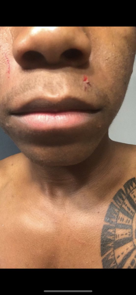 D_Will98's tweet photo. So since we Tellin stories... this Bitch was abusive, A Cheater, didn’t care for shit what her mother said cause I lived wit her every night while her mom was at work and she still tryna play victim 😂😂 fucking for weed 🥴🤦🏽‍♂️ 0/10 don’t recommend to cuff 🤮🤢 https://t.co/a1OCgvy0T0