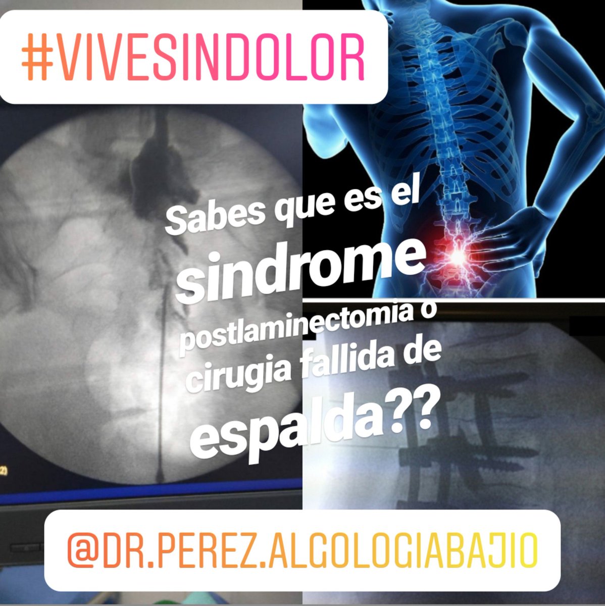 DrBajio's tweet photo. Te han operado de la columna y todavia tienes dolor?? Hay muchas opciones para ayudarte y que no tengas que sufrir de dolor #VIVESINDOLOR
#ALGOLOGÍA
#ALGOLOGÍAINTERVENCIONISTA
#PAINMEDICINE https://t.co/MJT5HwcPku