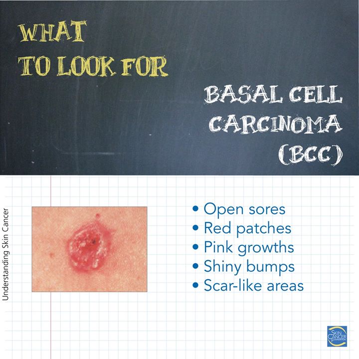 Treasure Valley Dermatology tweet media