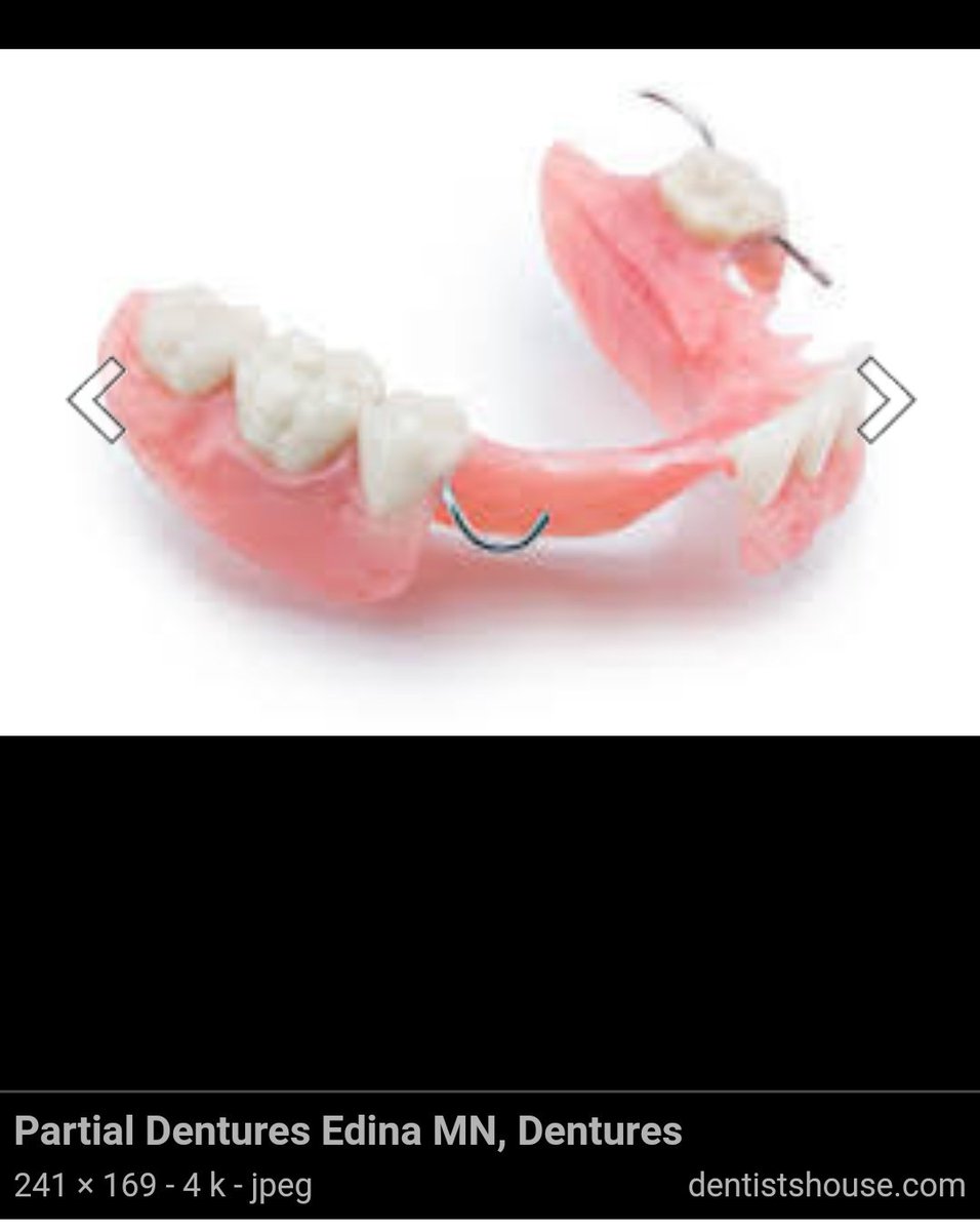 Lalu ada gigi tiruan lepasan. Gigi tiruan lepasan ada yang sebagian ada yang seluruhnya. Bahannya yg sering dipake ada yang dari akrilik dan valplas.