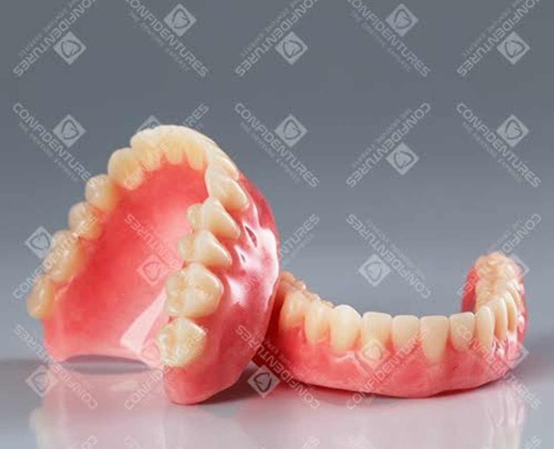 Lalu ada gigi tiruan lepasan. Gigi tiruan lepasan ada yang sebagian ada yang seluruhnya. Bahannya yg sering dipake ada yang dari akrilik dan valplas.