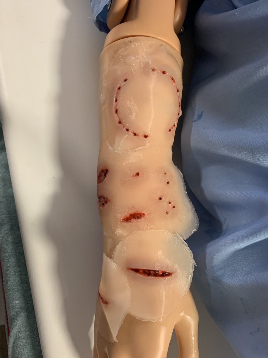 PICUDoc23's tweet photo. SbHDT for ED! Such a wide variety of pathology and clinical scenarios for these front line providers. Taking into consideration how design elements support care of routine and emergency care and creating flexibility in the space to do so! #Designingforsafety #Makingithappen https://t.co/mmzII8EZTR