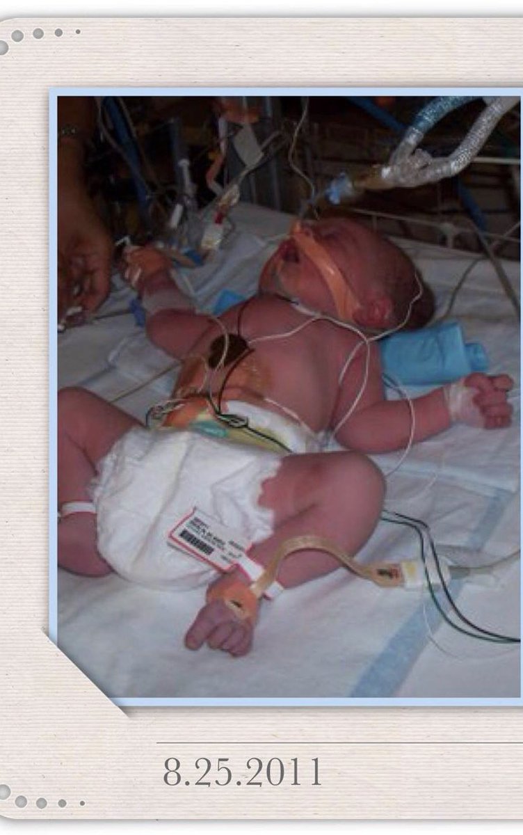 4nicudads's tweet photo. 8 years ago we walked into #MSCHONY with a 50% chance of bringing this child home. Today we celebrate his 8th Birthday! So blessed and thankful for all the doctors who have helped us with this special miracle! @BillPulte___  please bless this amasing hospital @nyphospital https://t.co/Qe4GAzDoN0
