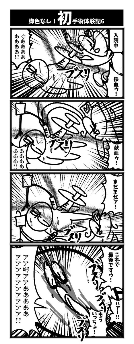 ４コマ【初手術体験記6】初投稿です 
