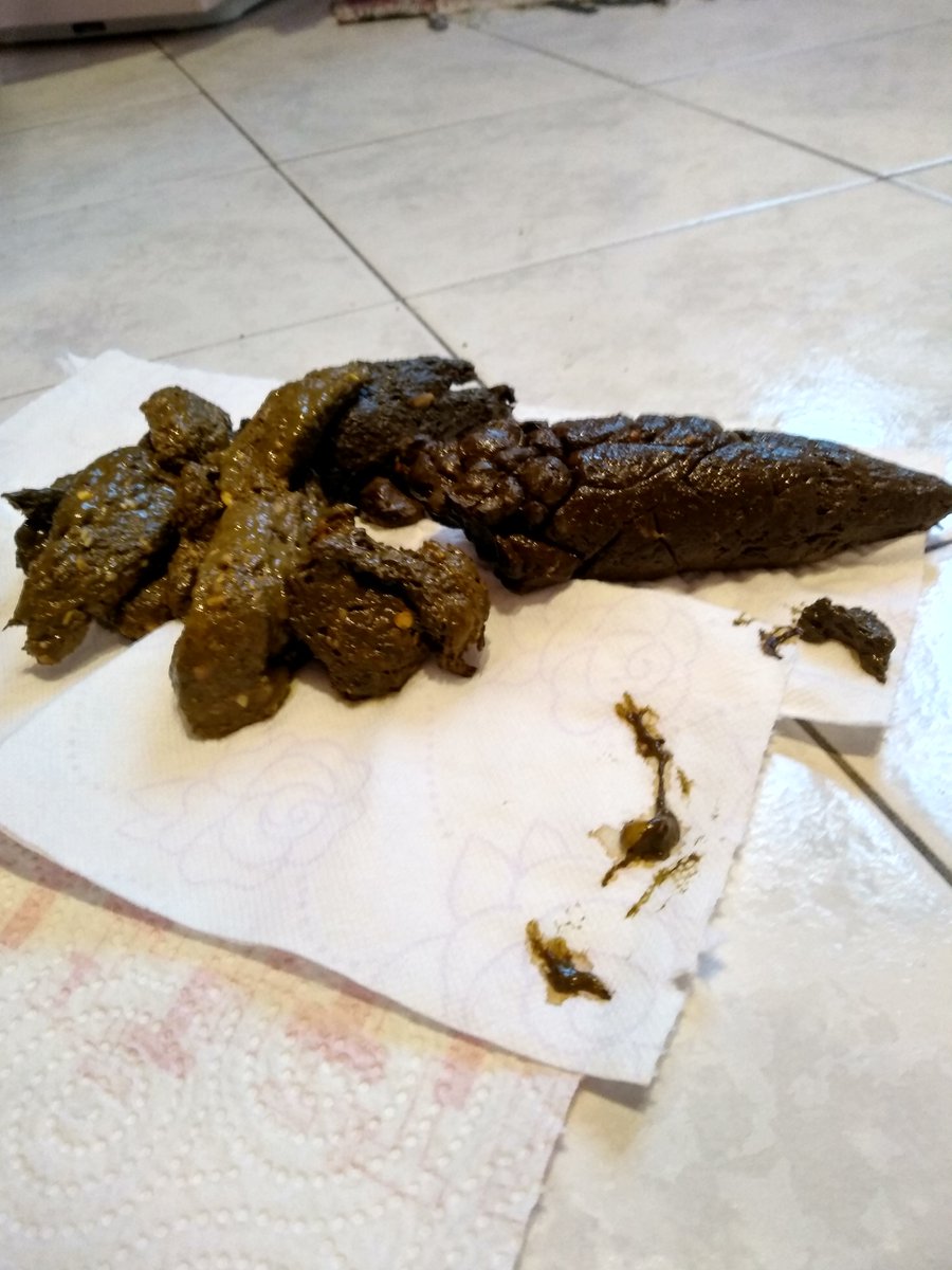 Mrperverse666's tweet photo. My shit of 01-25-2019

#extreme #nasty #disgusting #shit #scat #coprophagy https://t.co/V944OlCtxx