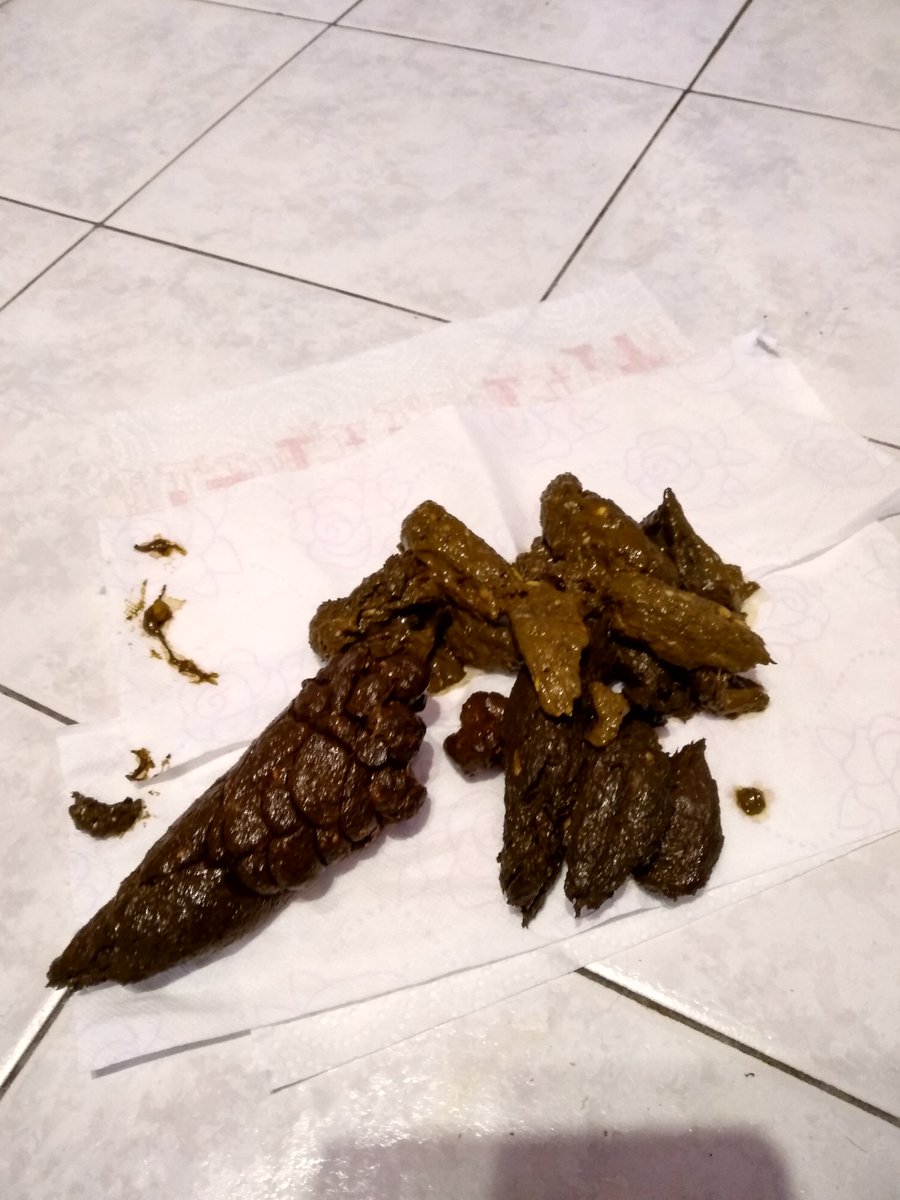 Mrperverse666's tweet photo. My shit of 01-25-2019

#extreme #nasty #disgusting #shit #scat #coprophagy https://t.co/V944OlCtxx