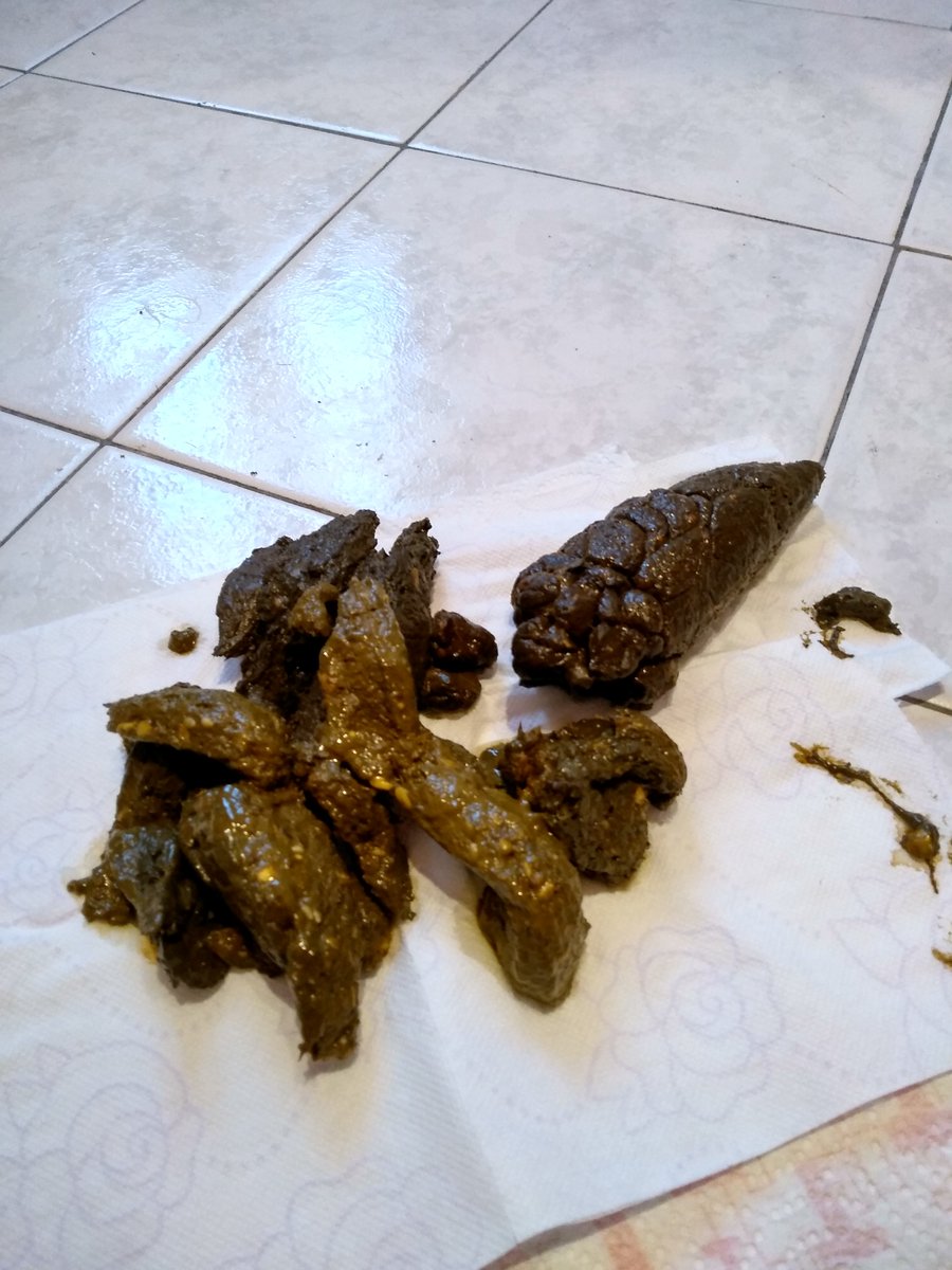 Mrperverse666's tweet photo. My shit of 01-25-2019

#extreme #nasty #disgusting #shit #scat #coprophagy https://t.co/V944OlCtxx