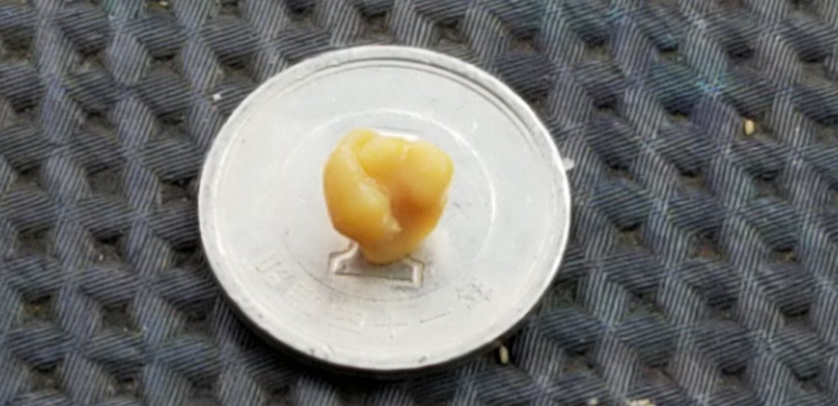 まぐあき くしゃみと共にでっかい臭い玉出てきた 臭い玉