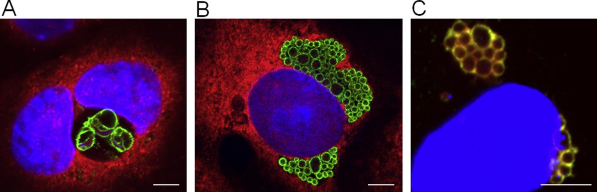 MicrobesInfect's tweet image. Chlamydiales, #Anaplasma and #Bartonella:

Persistence and immune escape of intracellular bacteria.

sciencedirect.com/science/articl… #Chlamydia #openaccess