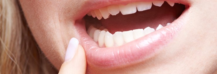 salma_357's tweet photo. checkout Glasgow Medical Center In Dubai to cure your dental problems. Whoever suffering from gum problems this will be a great solution.....
https://t.co/yFaJPZ22bS
#dentalproblems #gumproblems https://t.co/B98zQKsUry