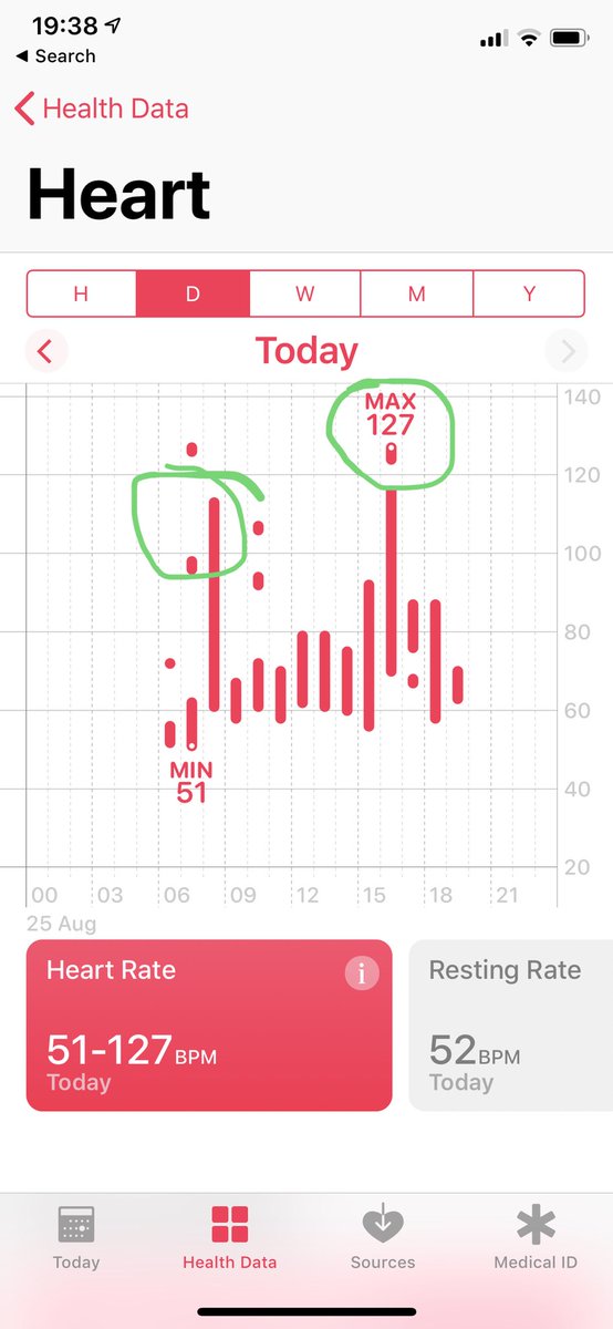 edbaker1965's tweet photo. The Ashes effect in one picture. My resting pulse is 50 my moderate jogging pulse is 115 when @benstokes38 was doing his thing #EngVsAus it was 127 and I was sat on the sofa. I bet his pulse was far lower. When I present to hundreds it doesn’t rise above 100 #StressinAction https://t.co/vm8UI0xc8R