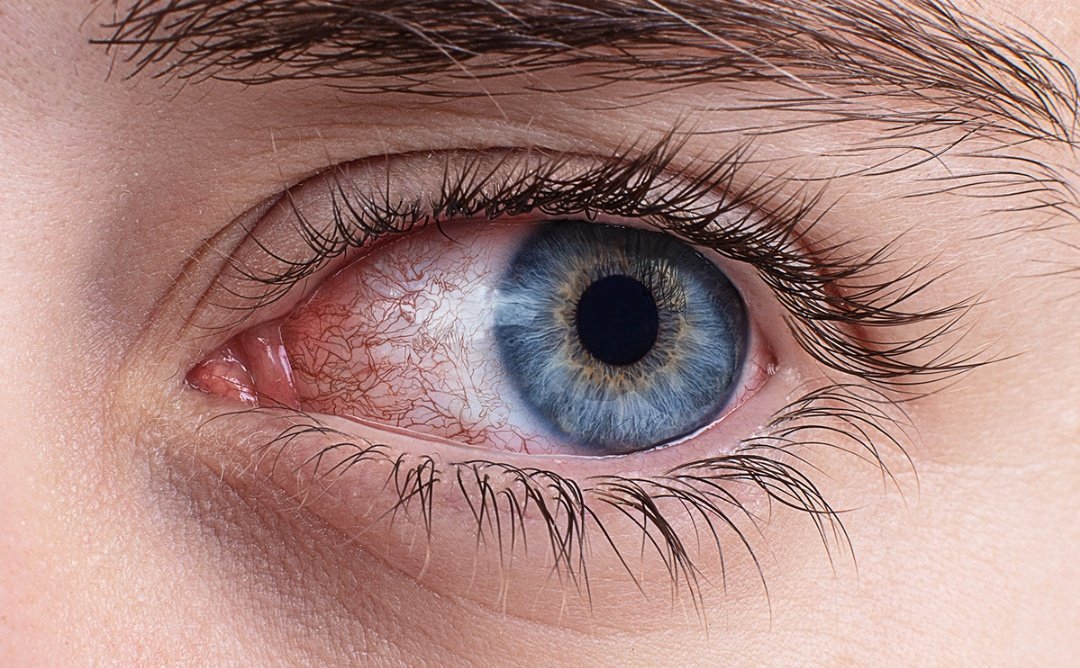 kansaita_'s tweet image. Estos trabajos son del ilustrador Diego Salas.

A simple vista son fotos de ojos enrojecidos.

Ahora haced zoom en las imágenes. 

Es: flipante.