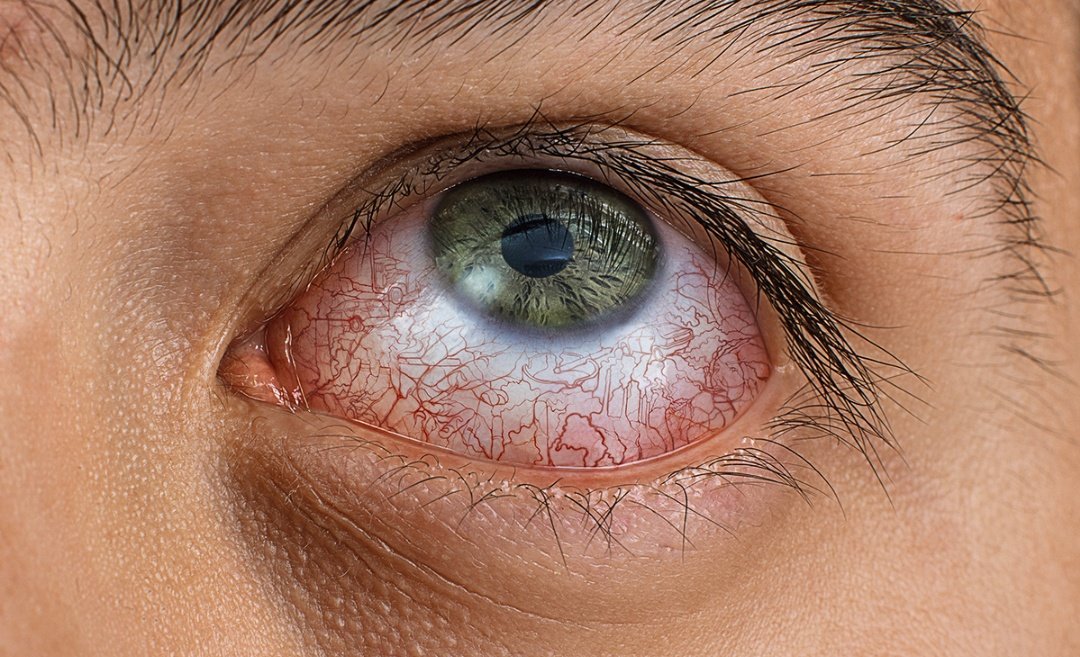 kansaita_'s tweet image. Estos trabajos son del ilustrador Diego Salas.

A simple vista son fotos de ojos enrojecidos.

Ahora haced zoom en las imágenes. 

Es: flipante.