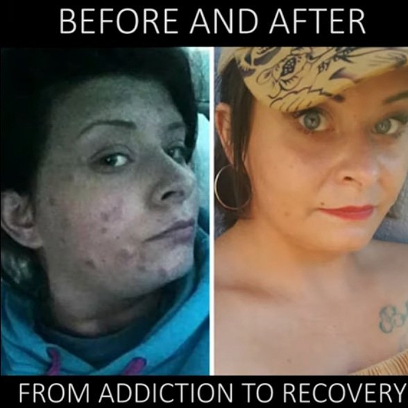 Carriesoutreach's tweet photo. From feral like to fabulous
#Addiction #Recovery #Absitance #Change #Courage #Strength https://t.co/P3eDkzb9tL