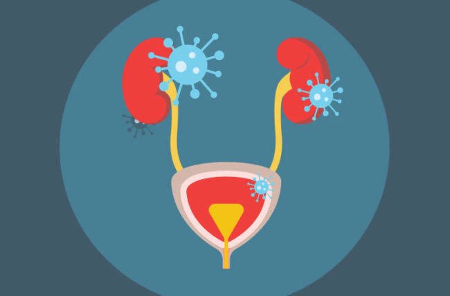 #Mitos sobre #infeccionesurinarias: 1. La orina es turbia y huele mal entonces el paciente tiene infección 🚫 2. Si en orina hay bacterias entonces hay que dar antibiótico ❌ 3. Todos los pacientes con bacteriuria progresarán a infección ⛔️ 4. Piuria es igual a infección ❌