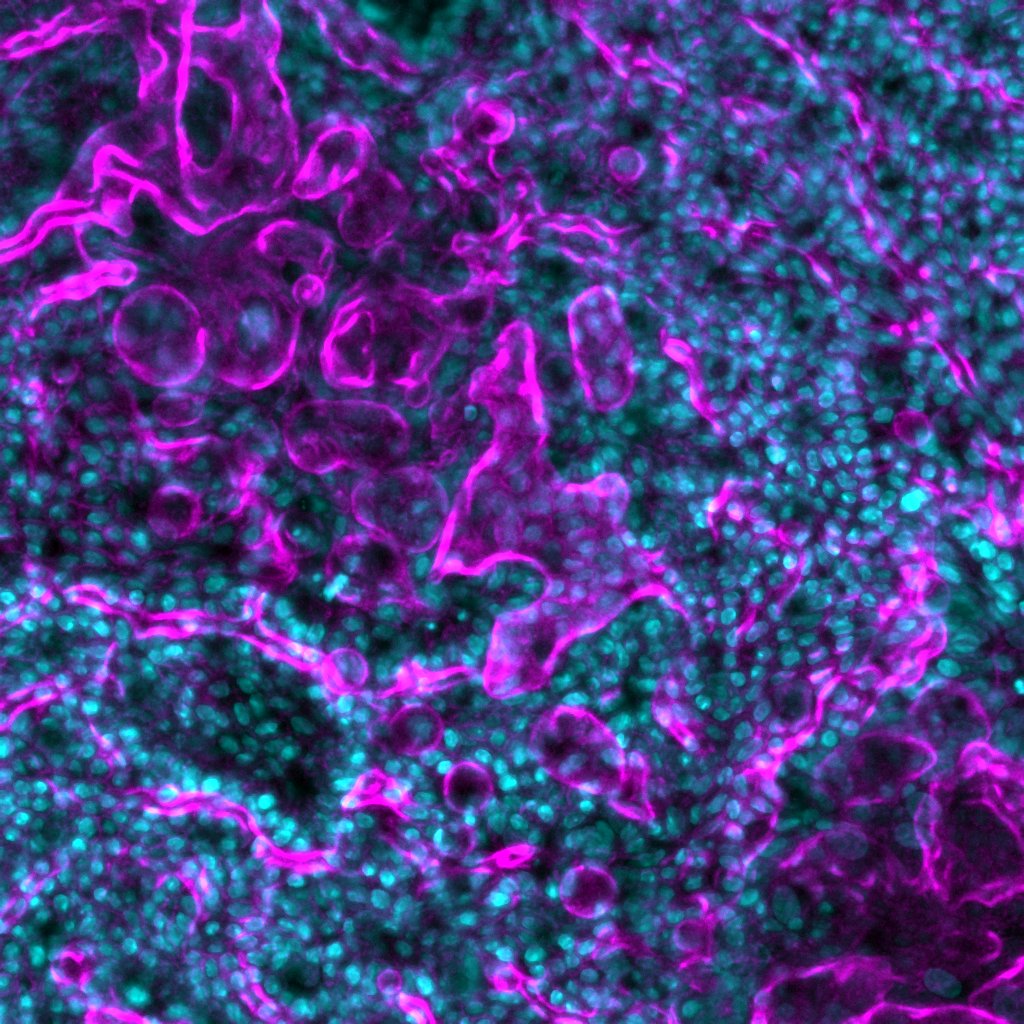 emulateinc's tweet photo. #OrgansOnChips and #organoids are complementary technologies. Organoids can be used as a cell source to enable human-relevant disease modeling. Read our approach and relevant publications, https://t.co/QwjiCYkdk4. https://t.co/cs7RxfNr4T