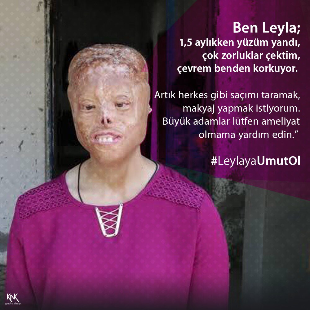 grafucyus's tweet photo. Hadi #LeylayaUmutOl’alım! Leyla’nın bize ihtiyacı var! https://t.co/YBJX8WXHHA