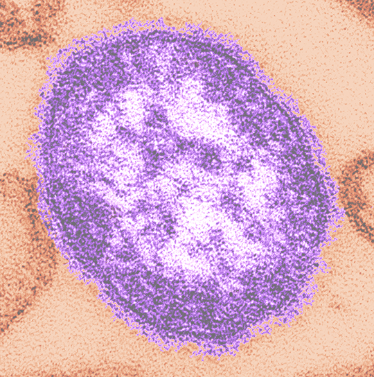 Maricopahealth's tweet photo. UPDATE: Additional Sites Added Where Individuals May Have been Exposed to #Measles in Maricopa County. Read more at https://t.co/OU15o46y5p. https://t.co/kBZBV9OkJo