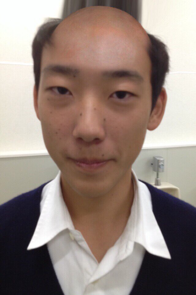 神戸大学男子ラクロス部 19 りき At 経営 4回生 あなたの髪の毛ありますか ハゲパゲそんなの嫌だ 髪の毛消え去っていく ハゲパゲハゲパゲハゲパゲはー T Co Wlo1xcbbns Twitter