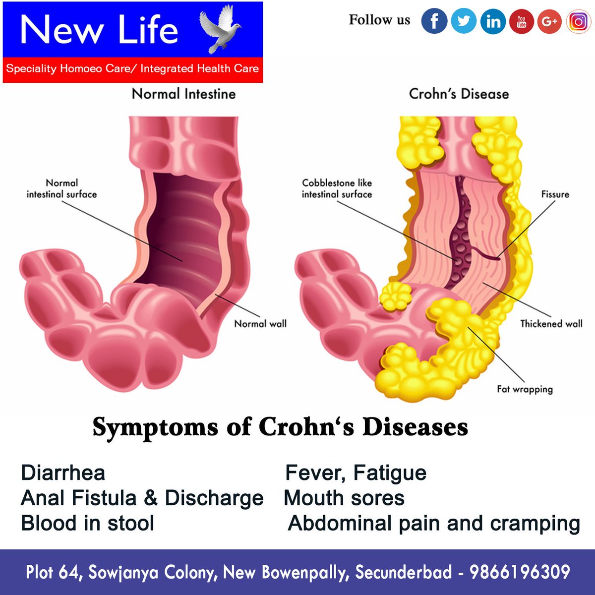 HomeoNew's tweet photo. Many difficult diseases who could not be relieved by experts of leading hospitals have recovered fully at our centre.
Closed : Wednesday and Sunday Evenings
Mail Id : newlifehomeocare9@gmail.com
Contact : 9866196309
https://t.co/ocPF7Nt16Y
#New #Life #Homeo #Care https://t.co/n6Mw30shHc