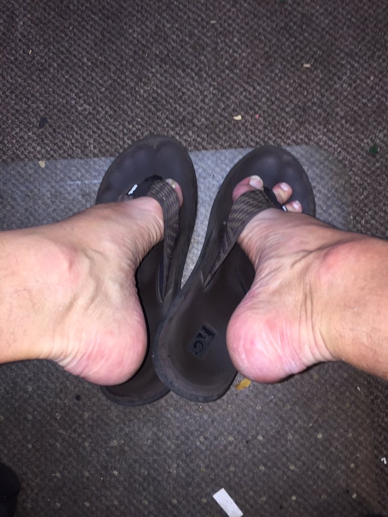 SteveTunes1's tweet photo. My feet in flip flops #myfeet #malefeetinflipflops https://t.co/Oeer7MiEDp
