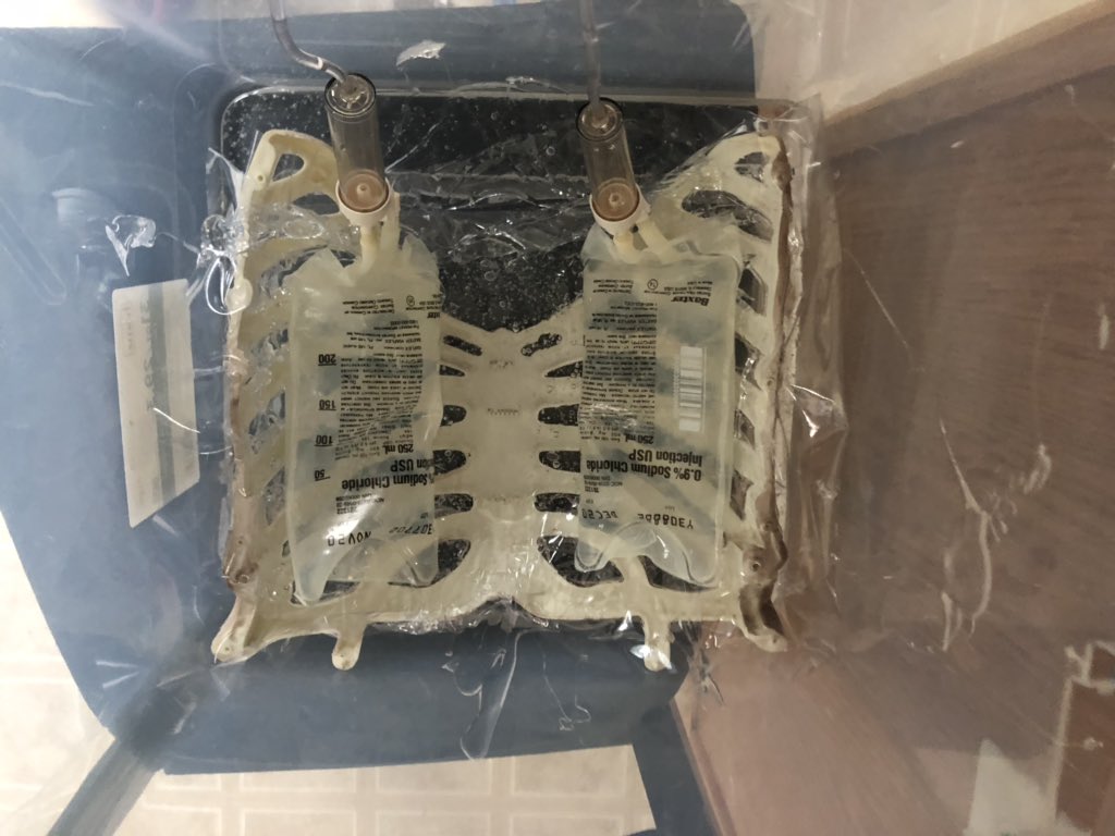 achpempocus's tweet image. #simlife #pempocusbootcamp2019 #thoracentesis #achpempocus