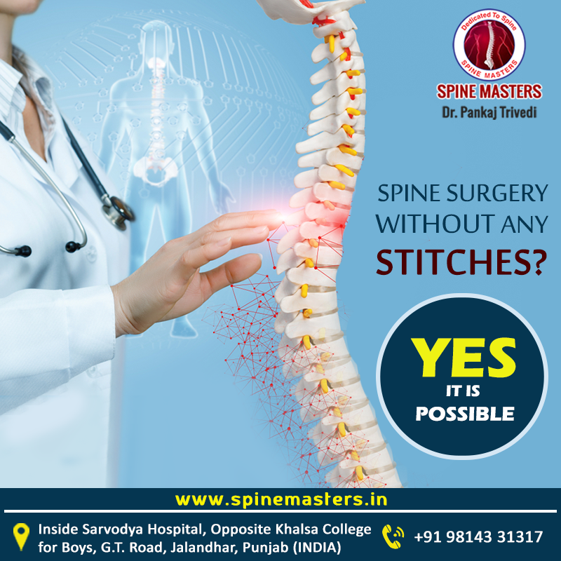 SpineMastersJal's tweet photo. Spine surgery without any stitches ! YES It's Possible with our Minimal Invasive Spine Surgery (MISS) procedure. 8mm cut, No stitches, No anesthesia, Back to work within 24 hours. Call : +91 98143 31317
#SpineMasters #DrPankajTrivedi #LaserSurgery #SpineSurgery #StitchlessSurgery https://t.co/7tuKZNYqRB