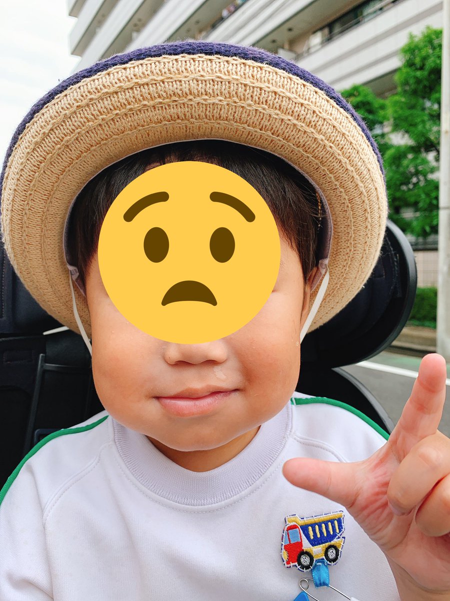 セレ Twitterissa 幼稚園から引き取って そにまま別の病院行ったら クインケ浮腫という蕁麻疹だと即座に診断され薬を処方された 病院によってこんなに対応変わるんだなぁ 最初の病院は息子のかかりつけだったけど もう使わん ちょっと遠くなるけど 今度 セレ Twitterissa 幼稚園から引き取って そにまま別の病院行ったら クインケ浮腫という蕁麻疹だと即座に診断され薬を処方された 病院によってこんなに対応変わるんだなぁ 最初の病院は息子のかかりつけだったけど もう使わん ちょっと遠くなるけど 今度