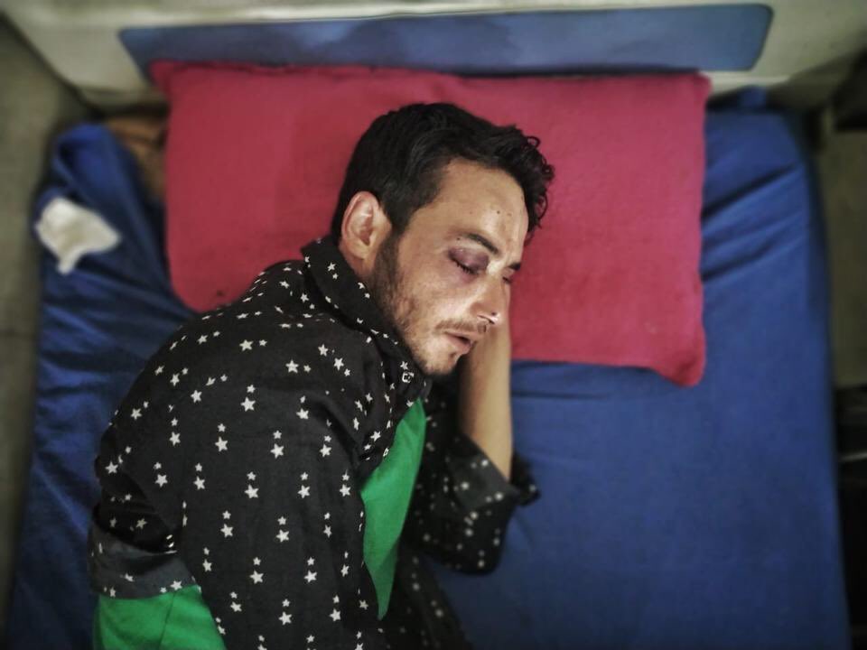 Waheed lies in a hospital bed after being wounded by 'pellets' fired by Indian forces as he played cricket in Srinagar. Doctors are not sure whether they can save his right eye. Modi today’s HITLER! 

#15AugustBlackDay
 
trtworld.com/magazine/as-ei…