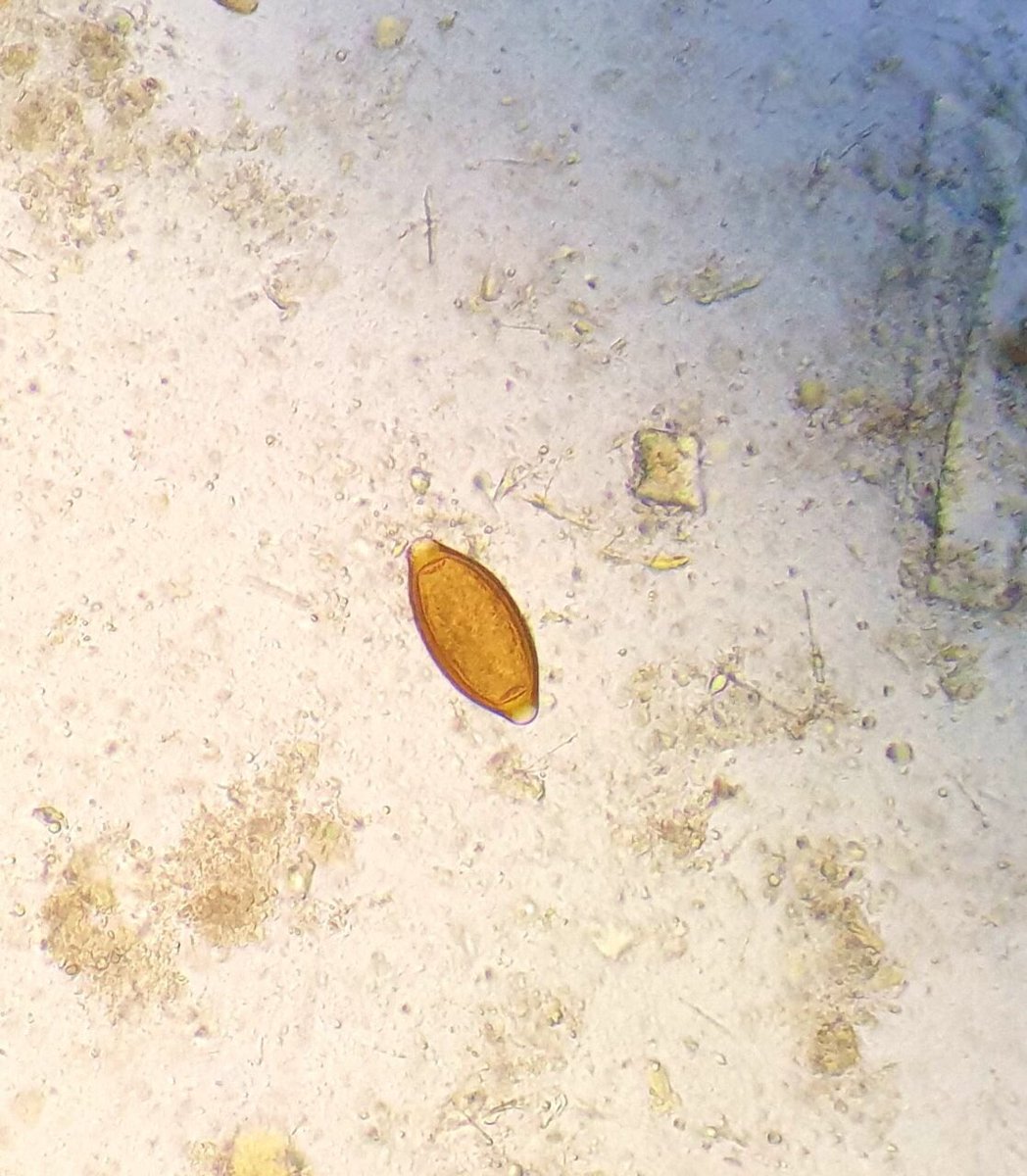 Fathimathzimna's tweet image. Make a diagnosis ? 
Specimen: Stool
 #labtechmovement #proudtobealabtech #wearlabcoats #microbiology #parasitology