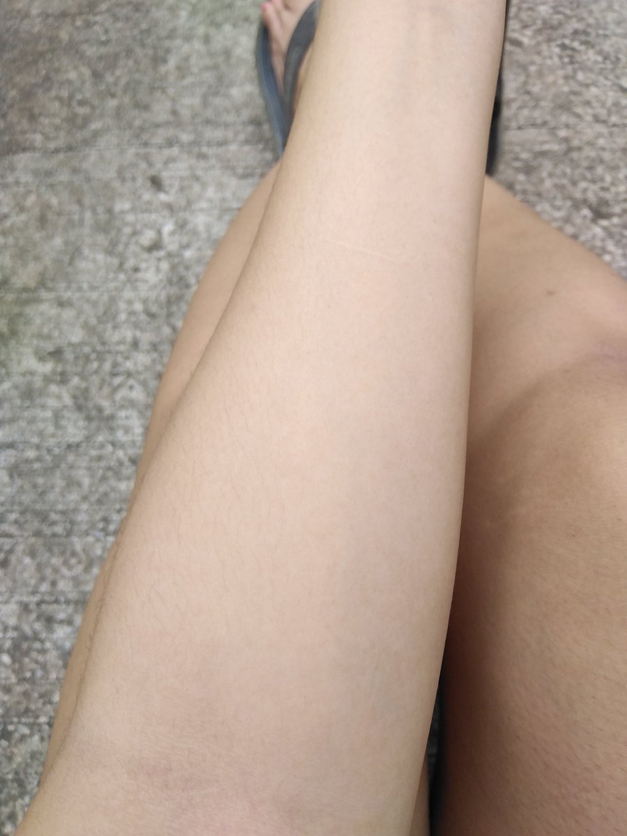 Bubblecatsuga's tweet photo. อะ​ ไหนๆรีวิวละเอาจริงๆจังๆเลย
นี่กินสีม่วงมา2เดือนละต่อด้วยสีชมพู1เดือน
ให้ภาพเล่าเรื่อง​ละกัน​ ภาพแรกแสงยามเย็น​อะนะมันก็ประมาณ​นั้น😂
ที่เหลือถ่ายแสงช่วงสายๆกล้องสดโนแอพไม่แต่งภาพคับ​ ภาพสุดท้ายคือก่อนทาน​ ผิวคล้ำเสียแห้งกร้านมากเว่อ​ 😭
#ไว้รีวิวห้ามขายของโว้ยย
#HowtoPerfect https://t.co/uz2QoC8zH9