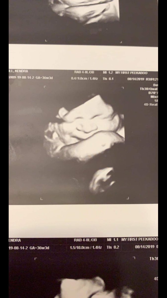 JessiTaaaylor's tweet photo. 🗣 Nepheeewwww💪🏼❤️😍💯🤝 https://t.co/fXEPFyv62m