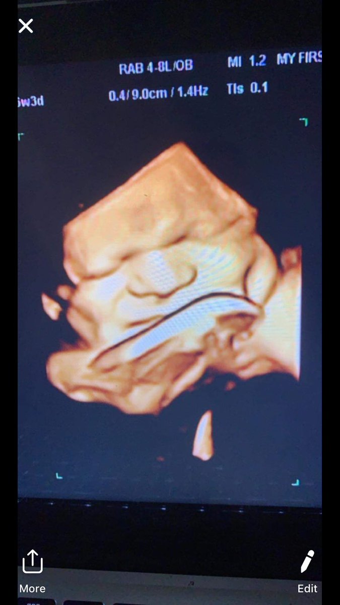 JessiTaaaylor's tweet photo. 🗣 Nepheeewwww💪🏼❤️😍💯🤝 https://t.co/fXEPFyv62m