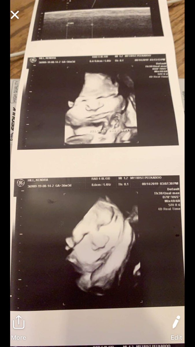 JessiTaaaylor's tweet photo. 🗣 Nepheeewwww💪🏼❤️😍💯🤝 https://t.co/fXEPFyv62m