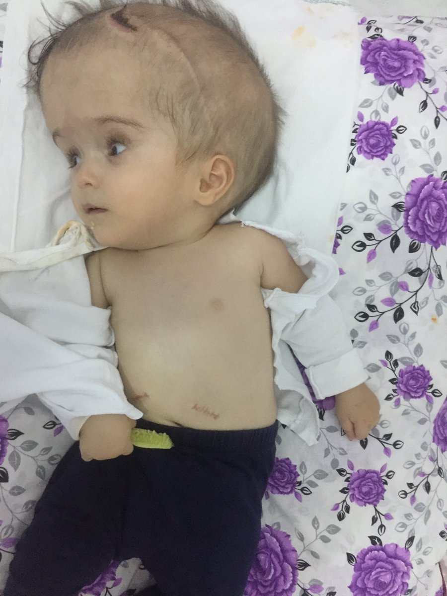 Herkese merhabalar küçük  masum  bu resimde gördüğünüz dünyalar güzeli bebeğin hepinizin yardımina ihtiyacı var.