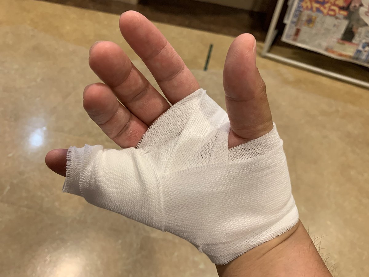 たすたけ まさかと思ったけどホントに折れてたwww