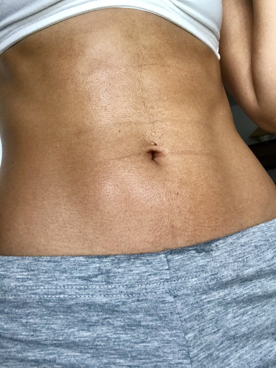 Marymar89M's tweet photo. ⚜️August=challenge month ⚜️
Ass 🆙
Sweating is 🆓
15th Aug - ✅
#stayfit #moveass https://t.co/nMOGwkhPX8