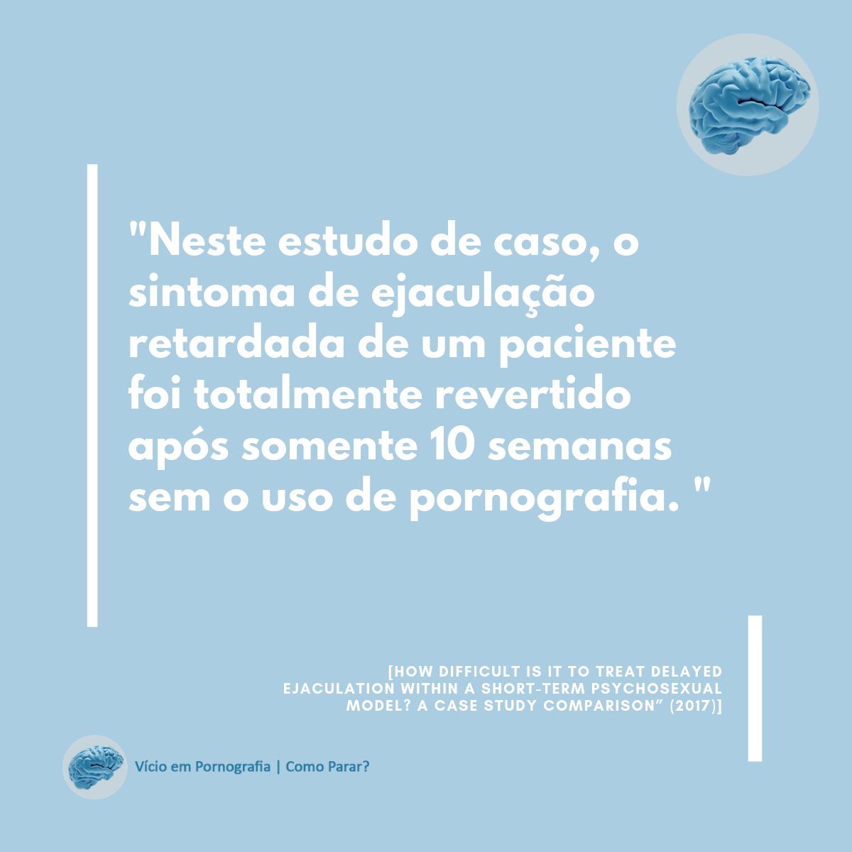 como_parar's tweet image. "Neste estudo de caso, o sintoma de ejaculação retardada de um paciente foi totalmente revertido após somente 10 semanas sem o uso de pornografia."
#ejaculacaoretardada #homens #ejaculacao #abstinencia  #vicio  #vicioempornografia