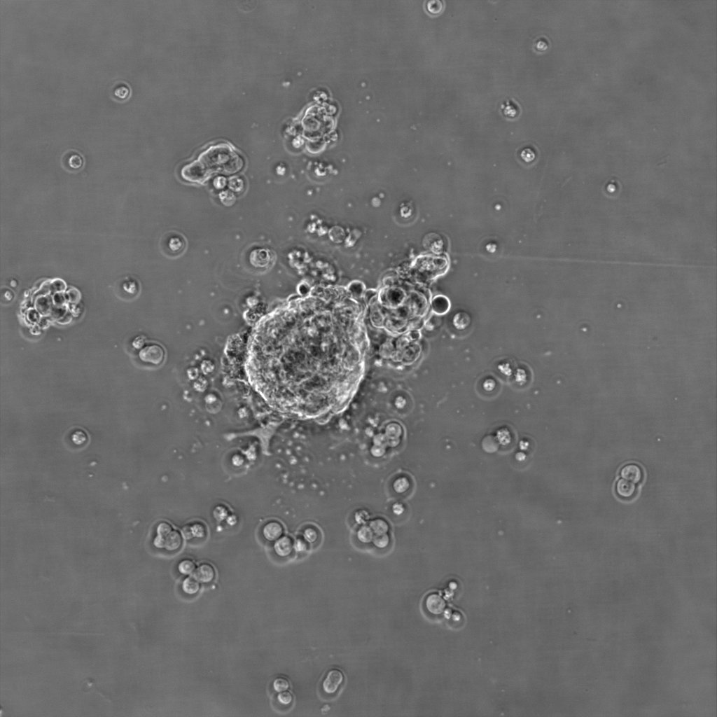 VeronikaMantzi1's tweet image. Day 4 with the @in2scienceUK students Aleena and Matthew! Their 24h #gastruloids look great! #ESCs #getin2science #department_of_genetics 🔬