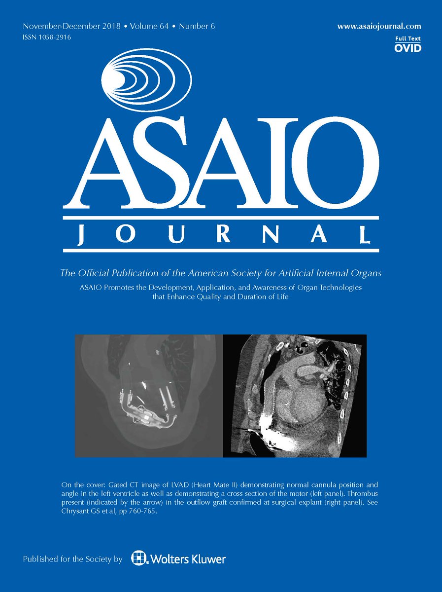 asaiojournal's tweet photo. All issues are #FREE 1 yr post-publication and the November-December 2018 issue is free early! https://t.co/2skryKkGai
#LVAD #ECMO #Impella #cardiogenicshock #MI #sexdifferences #infection #imaging #bioartificialkidney #PedsICU #ArtificalLung #iPSCs #VADCoordinators https://t.co/4BVr5Hjr4b
