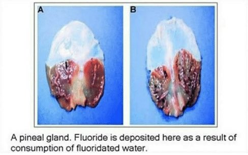 Some people think the fluoride in our water has calcified it. Like I said earlier, it’s possible that whoevers in charge doesn’t want us using the full capacity of our brain. Our brain is basically an organic quantum computer. We are capable of doing way more than we are led on.
