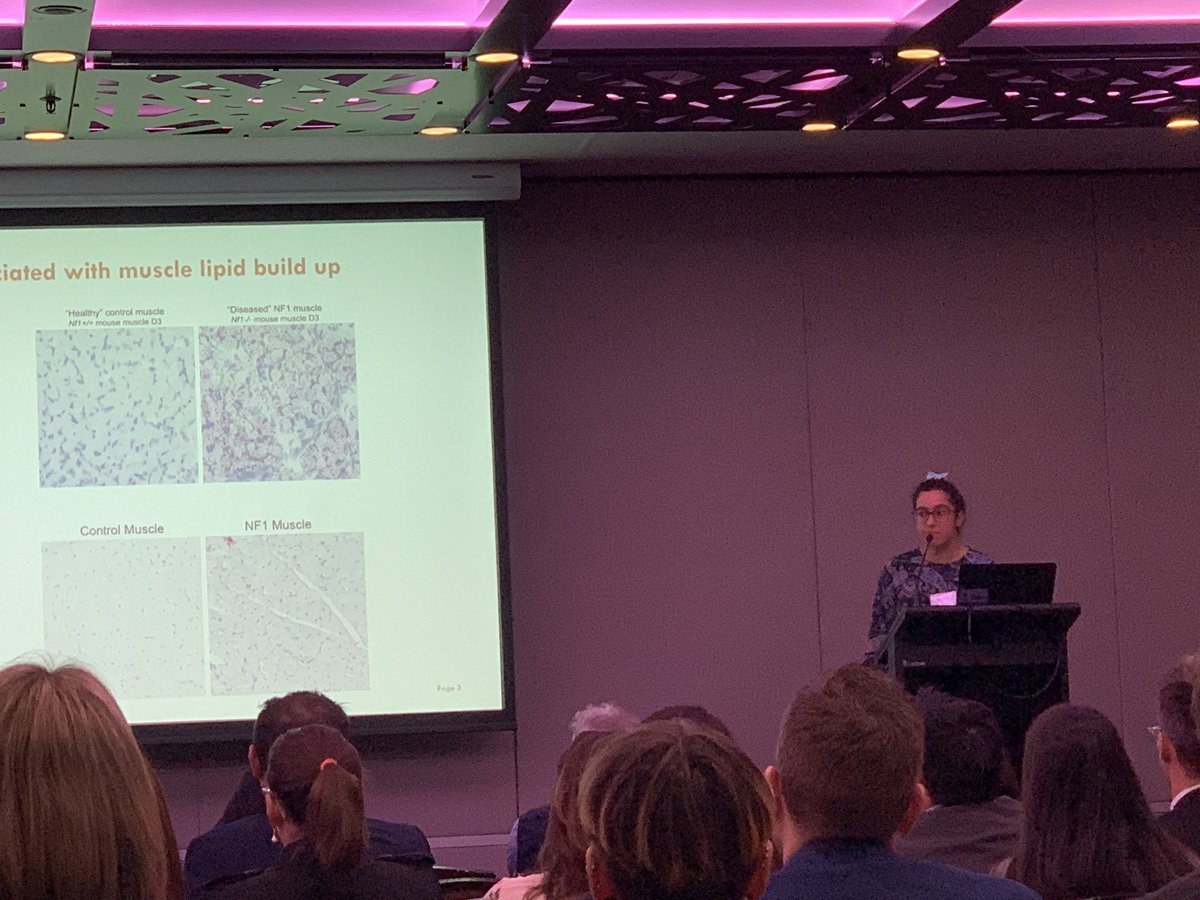 FabienneBrilot's tweet photo. Progress on NF1 research: @EmilyVasiljevs1 from @Stress_Westmead and @kids_research discusses pathways from preclinical animal models to qualitative research on patient diet. #conquerNF @CTF_AU https://t.co/gDpRlq6hZd