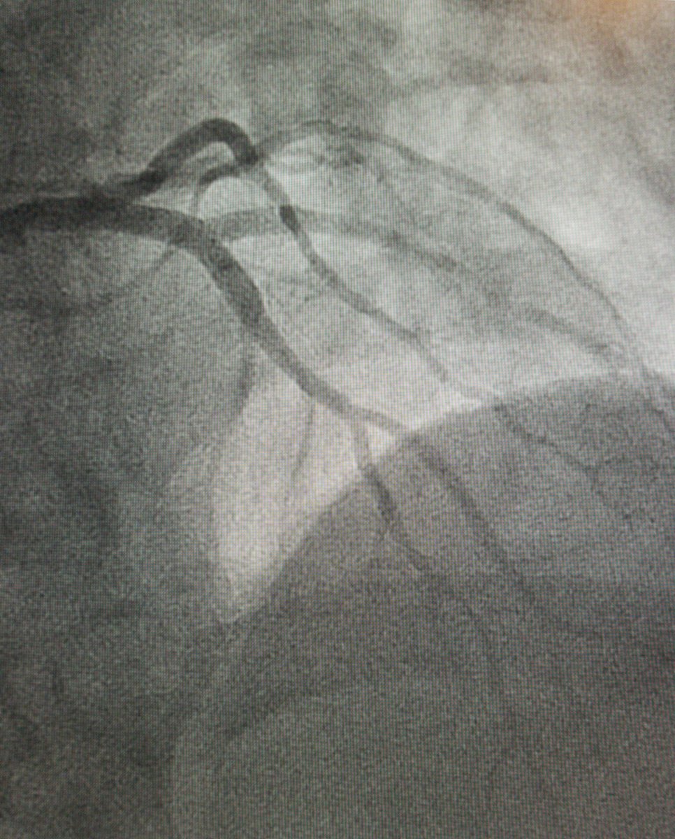 Jad Daye MD RPVI tweet media