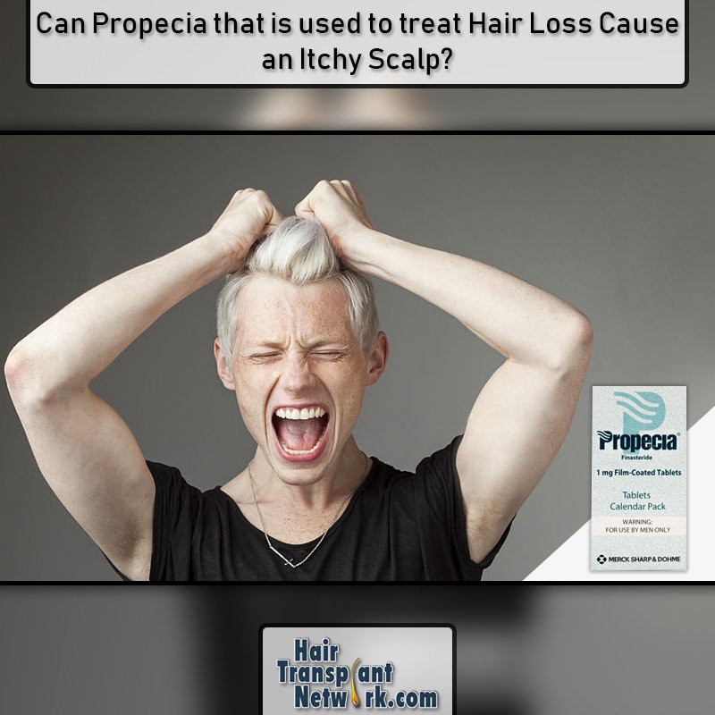 Hair Loss Chat On Twitter Can Propecia That Is Used To Treat