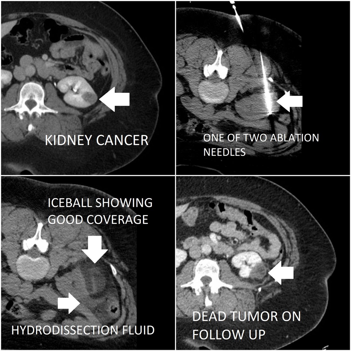 the true gospel the true gospel preached