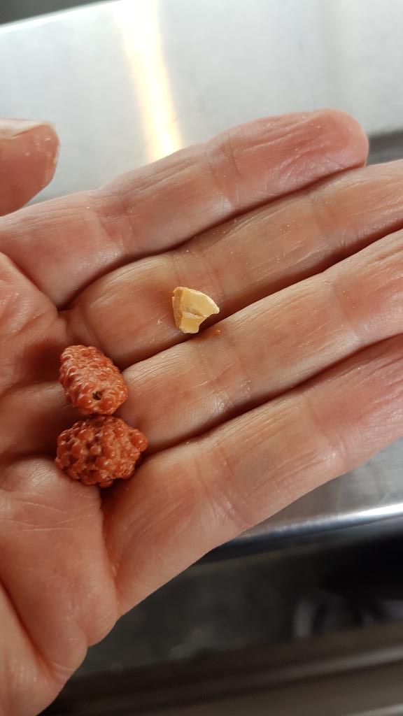 sambolton007's tweet photo. #frischundlecker NEIN! #banhoff #geisenkirchen nothing to eat that is not covered in sugar or chemicals. Certainly not fresh and not good! Had to pick sugar coating off the nuts - wasps for sugar everywhere - horrible! Nothing healthy or edible if low glycemia #diabetes #T1D https://t.co/FJUuvcOt05