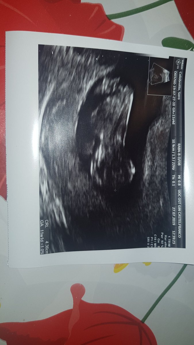 ingretasarms19's tweet photo. Fra 6 mesi divento mamma https://t.co/xsYqIUkg4q