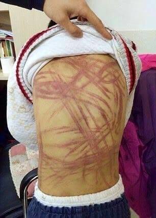 xBx73mOl77qBATH's tweet photo. Abused people inside Iran, down with #Islamic_Terrorist_Regime https://t.co/cCVBGqF2TZ